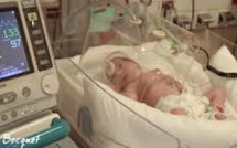 Suisse : des caméras pour le suivi médical des bébés prématurés