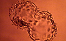 Dépakine: entre 2.000 et 4.000 cas de malformations majeures (Agence du médicament)