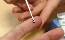 325 millions de personnes touchées par l'hépatite (OMS)