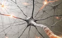 Sclérose en plaques: la piste de la réparation des neurones