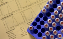 AFLD: inquiétudes pour les amateurs, les sports de combat et le rugby à XIII