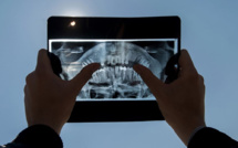 Les femmes souffrant d'infection chronique des gencives ont un risque accru de cancer