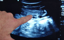 Le zoo de Beauval se prépare fébrilement à la naissance des premiers bébés pandas de France