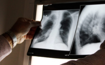 Tuberculose : opérations de dépistage à Mahina, Papeete et Pirae