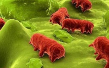 Point sur les cas de salmonellose à Taravao