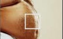 Quel que soit son poids, un gros ventre est dangereux pour la santé (étude)