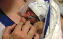 Un test sanguin peut prédire une naissance prématurée, selon une étude