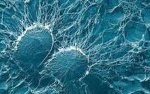 Staphylocoque doré chez des sujets sains : phénomène qui inquiète la médecine