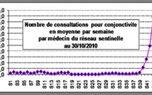 Avis à la population: Epidémie de conjonctivite en Polynésie française