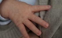 Bébés sans main: un 8e cas identifié dans l'Ain