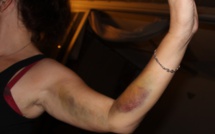 Les inscriptions pour le diplôme d’université sur les violences familiales sont ouvertes