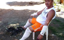 Attaque de chiens à Faa’a : « J’ai cru que c’était ma dernière heure »