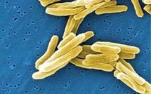 La tuberculose en Polynésie française