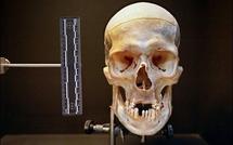 Un crâne humain retrouvé par des promeneurs à Moorea