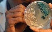 Bactérie tueuse : "la plus grosse épidémie de syndrome hémolytique et urémique"