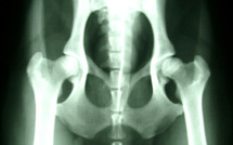 Alerte à l'irradiation excessive par imagerie médicale (ASN)