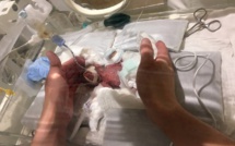 Japon: né à 268 grammes, un bébé garçon quitte l'hôpital en bonne santé