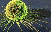 USA: les hommes meurent plus de cancer que les femmes, selon une étude