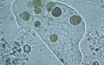 USA: trois morts à la suite d'une infection rare du cerveau par une amibe