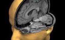 IBM met au point la première puce imitant le cerveau humain