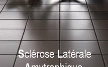Une cause commune à toutes les formes de Sclérose latérale amyotrophique