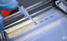 Un séropositif sous traitement efficace ne transmet pas le VIH, selon une étude