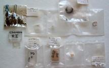 Médecine légale: Une mèche de cheveux, une mine pour savoir à quoi une personne a été exposée