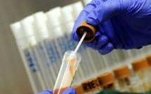 Des cellules centenaires retrouvent toute leur jeunesse