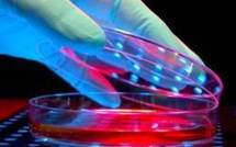 Guérir avec les cellules souches adultes: le Vatican se mobilise