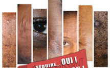 Les produits pour s'éclaircir la peau : attention danger !