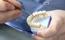 Soins dentaires: bientôt plus de transparence sur l'origine des prothèses