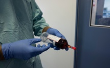 La chimiothérapie par aérosol, source d'espoir pour les malades du cancer