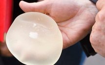 Prothèses PIP frauduleuses: un numéro vert réactivé