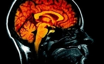 Exploration du cerveau: lire des images aujourd'hui, des pensées demain?