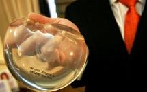 Prothèses PIP: première information judiciaire, deuxième décès signalé