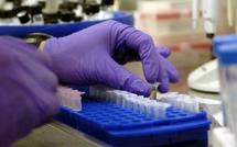 Virus mutant de la grippe aviaire: la science a-t-elle fabriqué un monstre?