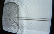 Un autre couple a porté leur enfant: une famille californienne attaque une clinique en justice