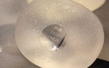 Prothèses PIP: le gouvernement recommande le retrait "à titre préventif"