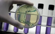 Cancer de la prostate: confirmation de l'inutilité des tests systématiques