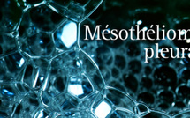 Déclaration désormais obligatoire pour le mésothéliome (cancer lié à l'amiante)