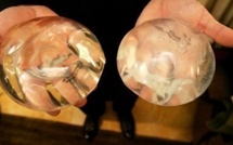 Prothèses PIP : principales propositions du rapport DGS/Afssaps