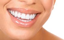 Privés de soins sur les lèvres, les chirurgiens-dentistes montrent les dents