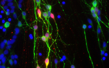 Maladie de Parkinson: progrès chez des singes grâce à des cellules souches