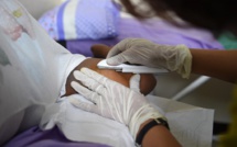 Une association alerte après deux cas d'implants contraceptifs dans les poumons