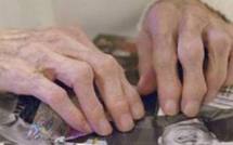 USA: un nouveau marqueur d'Alzheimer pour prédire l'évolution de la maladie