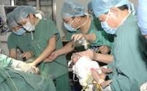 Deux petites filles siamoises séparées avec succès à Barcelone