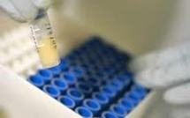 L'essai clinique d'un nouveau cocktail antituberculeux porteur d'espoirs