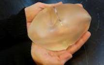 Implants PIP: des taux de rupture plus élevés que prévu