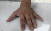 Yémen: 78 enfants morts de la dengue, Save the Children craint une épidémie