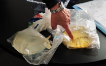 Implants PIP: l'indemnisation pouvait être limitée aux patientes en France